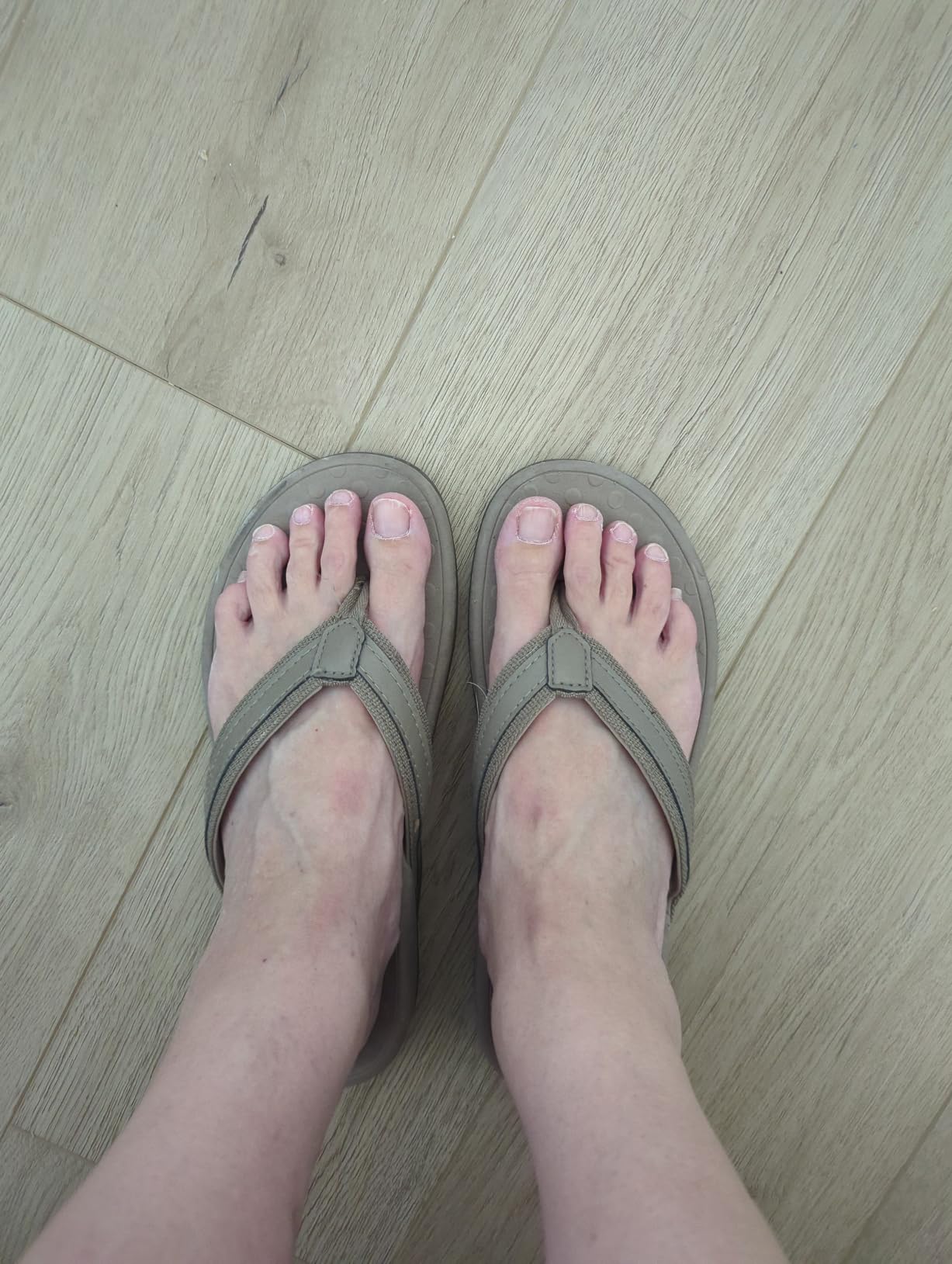 LLSOARSS Plantar Fasciitis Feet Sandal with Arch Support - Best Orthotic flip Flops for Flat Feet,Heel Pain- for Women customer photo 1